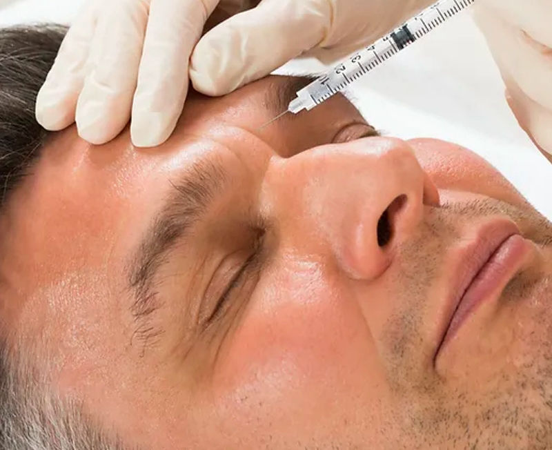 BROTOX® Injections For Men