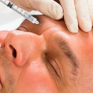 Brotox treatments skin - Burlington botox clinic